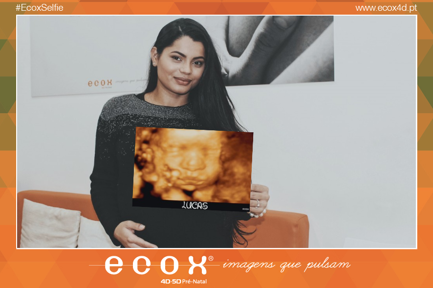 Ultrassom emocional Ultrassom 4D de Mamã Ana veio conhecer o seu pequeno Lucas ♥