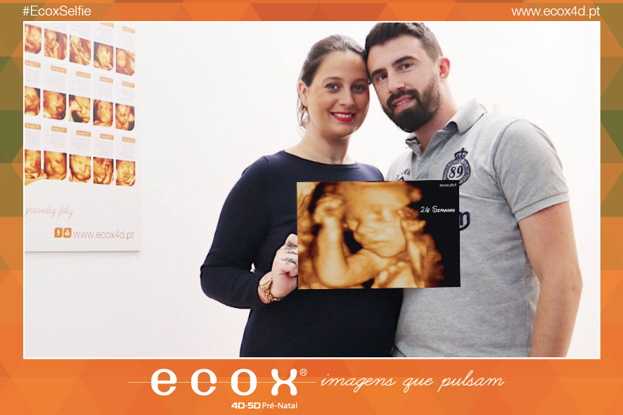 Ultrassom emocional Ultrassom 4D de Mais uma vez a mamã Daniela Pimenta e o papá Pedro vieram até nós ♥