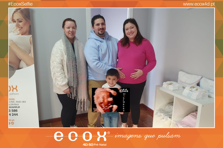 Ultrassom emocional Ultrassom 4D de Érica Soares