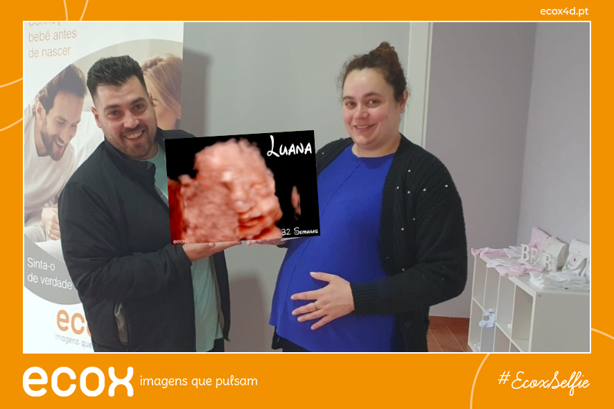 Ultrassom emocional Ultrassom 4D de Filipa 32 Semanas