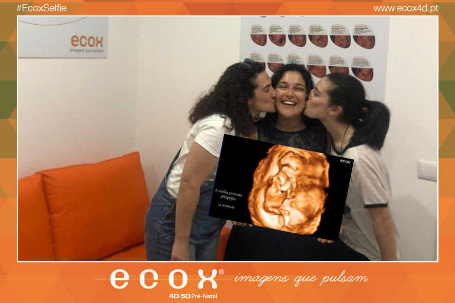 Ultrassom emocional Ultrassom 4D de Soraia Rodrigues e Família 14 Semanas