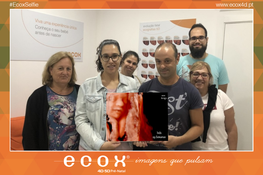 Ultrassom emocional Ultrassom 4D de Daniela Simões 28 Semanas