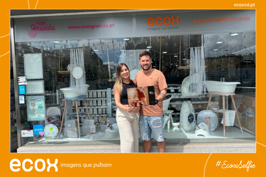 Ultrassom emocional Ultrassom 4D de JULIANA