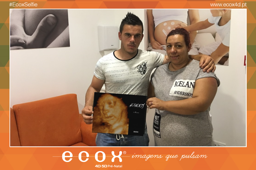 Ultrassom emocional Ultrassom 4D de Kelly