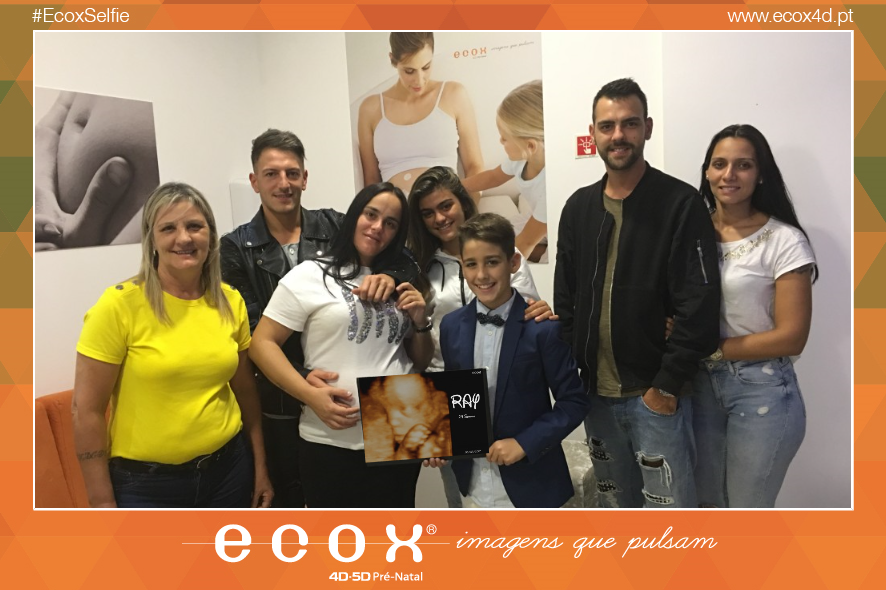 Ultrassom emocional Ultrassom 4D de ray