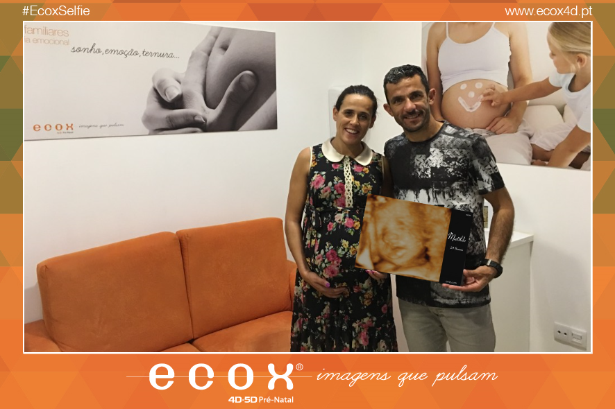 Ultrassom emocional Ultrassom 4D de Dulce Félix