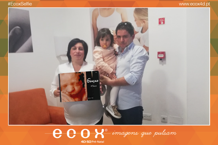 Ultrassom emocional Ultrassom 4D de Gonçalo
