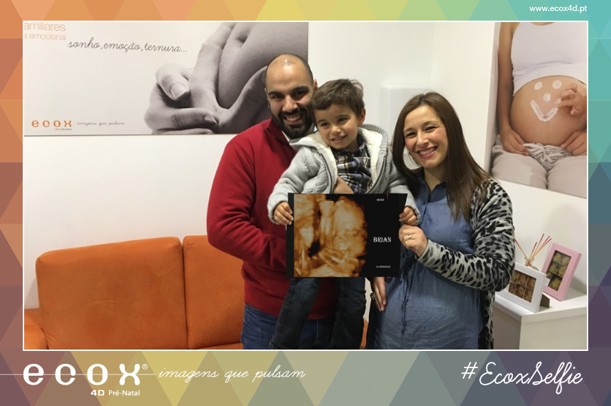 Ultrassom emocional Ultrassom 4D de brian