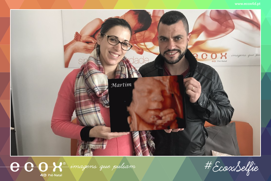Ultrassom emocional Ultrassom 4D de Martim e os papás!