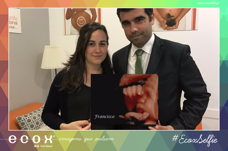 Ultrassom emocional Ultrassom 4D de Francisco e os seus papás!