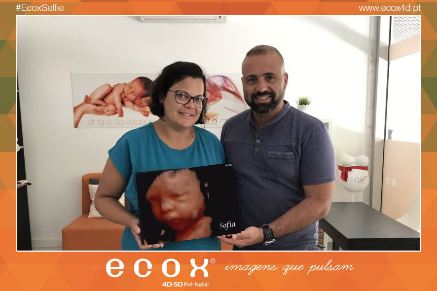 Ultrassom emocional Ultrassom 4D de A Sofia e os seus papás!