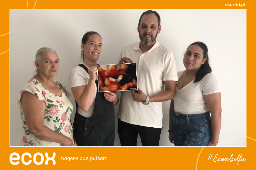 Ultrassom emocional Ultrassom 4D de Joana Inês Ribeiro Carvalho Ferreira