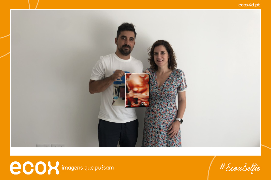 Ultrassom emocional Ultrassom 4D de Juliana Esmeralda Ferreira Sousa