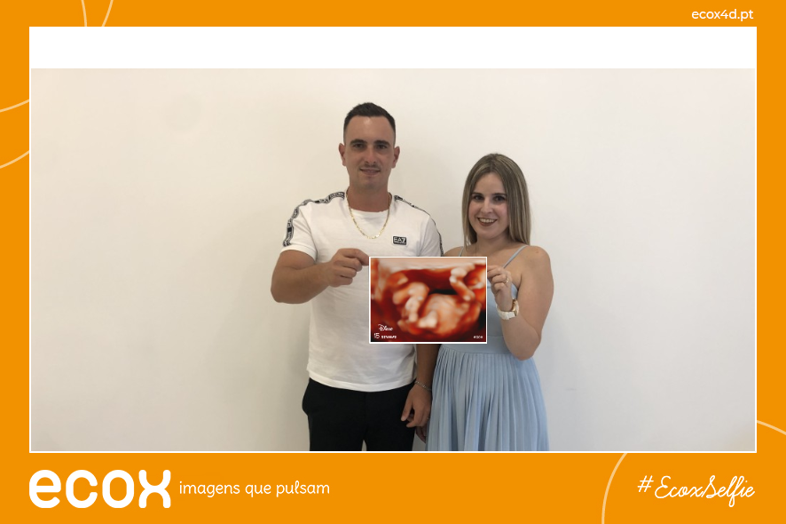 Ultrassom emocional Ultrassom 4D de Juliana Raquel Rocha Oliveira