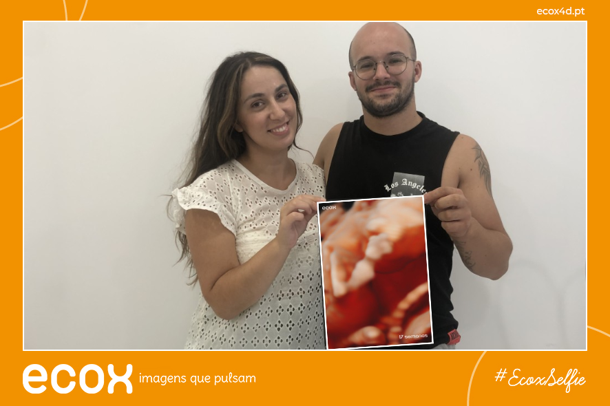 Ultrassom emocional Ultrassom 4D de Joana Catarina da Costa Trindade