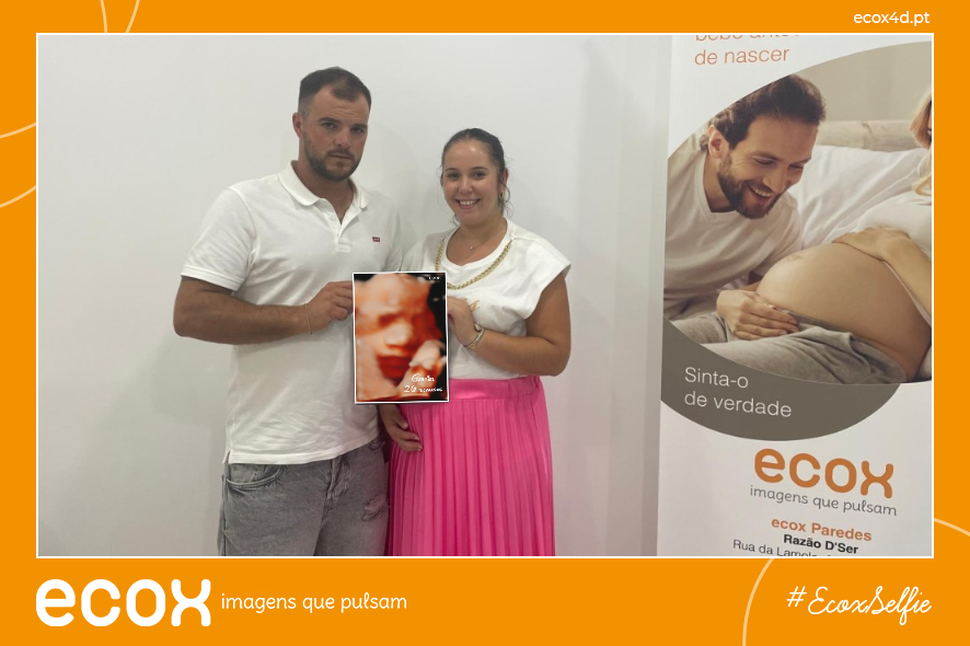 Ultrassom emocional Ultrassom 4D de Michele Filipa Sousa Rocha