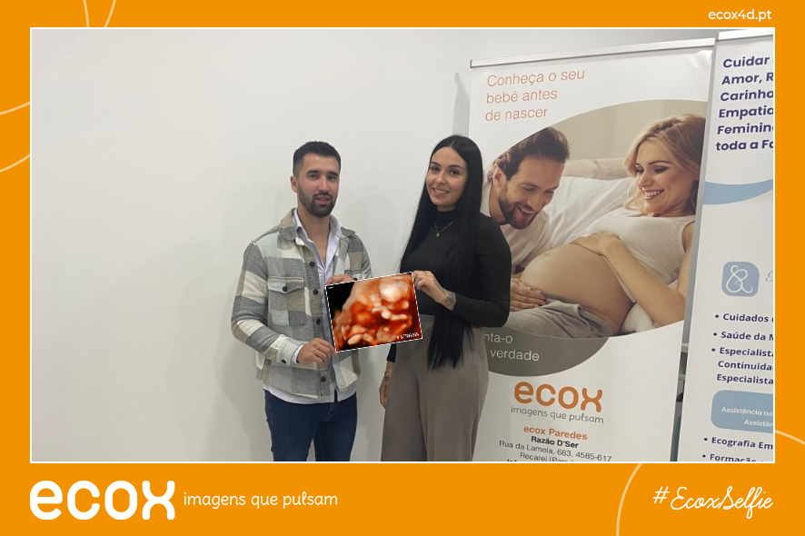 Ultrassom emocional Ultrassom 4D de Vânia Margarida Sequeira Ferreira