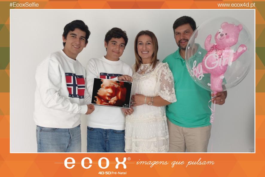 Ultrassom emocional Ultrassom 4D de Gisela