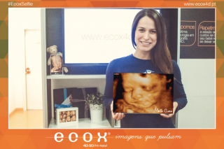 Ecografía emocional ecografía 4D de A mamã Patrícia Candoso veio conhecer a sua princesa ♥