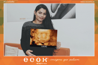 Ecografía emocional ecografía 4D de Mamã Ana veio conhecer o seu pequeno Lucas ♥