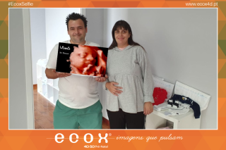 Ecografía emocional ecografía 4D de Rosa Oliveira 31 Semanas