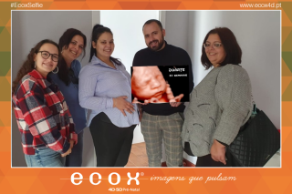 Ecografía emocional ecografía 4D de Filipa Oliveira 30 Semanas