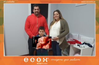 Ecografía emocional ecografía 4D de Ferreira Victória 29 Semanas