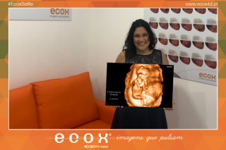 Ecografía emocional ecografía 4D de Soraia Rodrigues 14 Semanas