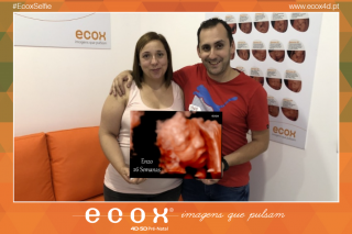 Ecografía emocional ecografía 4D de Emanuela Oliveira 26 Semanas