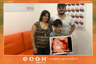 Ecografía emocional ecografía 4D de Conceição Longras 31 Semanas