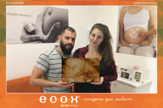 Ecografía emocional ecografía 4D de Sofia Alexandra