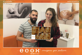 Ecografía emocional ecografía 4D de Alexandra Sofia