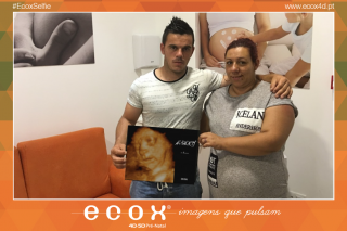 Ecografía emocional ecografía 4D de Kelly