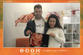 Ecografía emocional ecografía 4D de Noa e os seus papás!